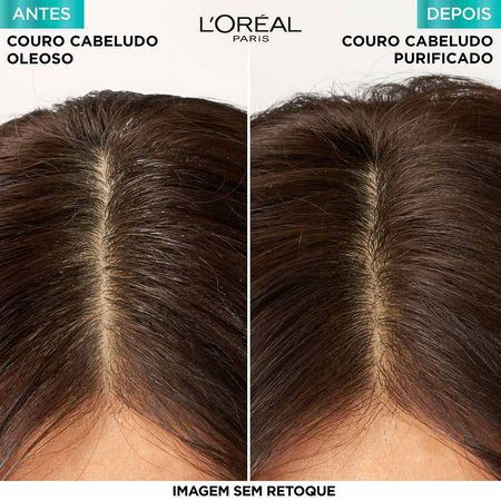 Shampoo-L'Oréal-Paris-Elseve-Pure-Hialurônico-200ml--5